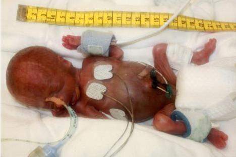 Levensvatbare baby van 275 gr…